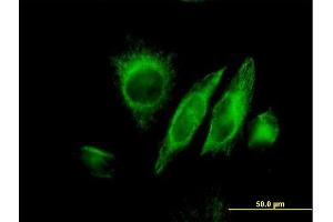 Immunofluorescence of monoclonal antibody to SPRY2 on HeLa cell. (SPRY2 antibody  (AA 1-315))