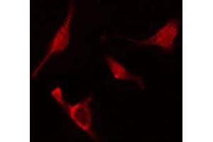ABIN6274820 staining A549 cells by IF/ICC. (ARL2BP antibody  (Internal Region))