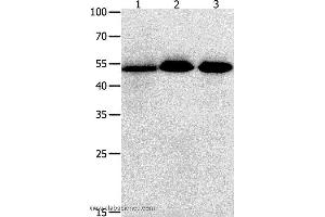 Western blot analysis of Human lymphoma , ovarian and  colon cancer tissue  , using KLF5 Polyclonal Antibody at dilution of 1:350 (KLF5 antibody)