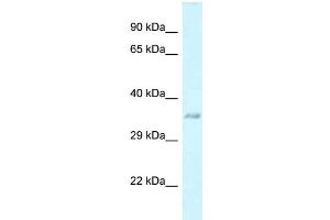 WB Suggested Anti-E130311K13Rik Antibody   Titration: 1. (C3orf33 antibody  (Middle Region))