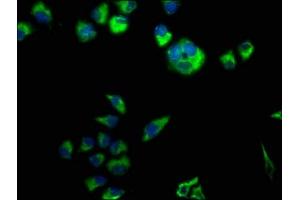 Immunofluorescence staining of Hela cells with ABIN7146593 at 1:50, counter-stained with DAPI. (Calsyntenin 3 antibody  (AA 197-408))