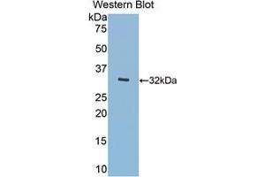 Western blot analysis of the recombinant protein. (MGEA5 antibody  (AA 319-450))