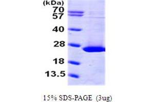 SDS-PAGE (SDS) image for ADP Ribosylation Factor Like GTPase 1 (ARL1) (AA 1-181) protein (His tag) (ABIN667171) (ARL1 Protein (AA 1-181) (His tag))