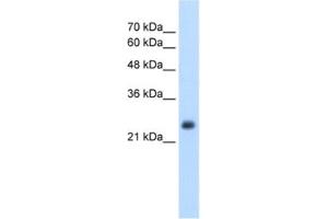Western Blotting (WB) image for anti-Nicotinamide N-Methyltransferase (NNMT) antibody (ABIN2462559) (NNMT antibody)