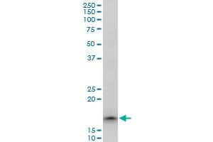 TOMM22 polyclonal antibody (A01), Lot # 051206JC01. (TOMM22 antibody  (AA 1-142))