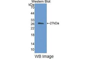 WB of Protein Standard: different control antibodies against Highly purified E. (CETP ELISA Kit)