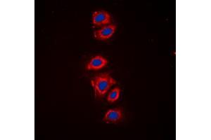 Immunofluorescent analysis of RPS6 (pS240) staining in HeLa cells.