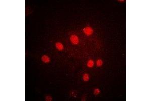 Immunofluorescent analysis of POLR1D staining in MCF7 cells. (POLR1D antibody)