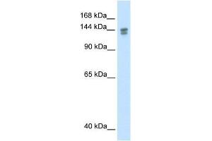 TP53BP2 antibody used at 1. (TP53BP2 antibody  (N-Term))