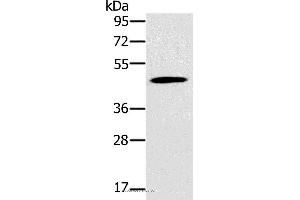 Western blot analysis of Mouse pancreas tissue, using KCNJ15 Polyclonal Antibody at dilution of 1:200 (KCNJ15 antibody)