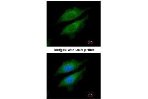 ICC/IF Image Immunofluorescence analysis of paraformaldehyde-fixed HeLa, using DPRP1 , antibody at 1:200 dilution. (DPP8 antibody  (N-Term))