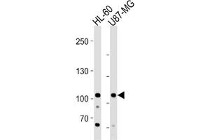 Western Blotting (WB) image for anti-MORC Family CW-Type Zinc Finger 3 (MORC3) antibody (ABIN3004591) (MORC3 antibody)