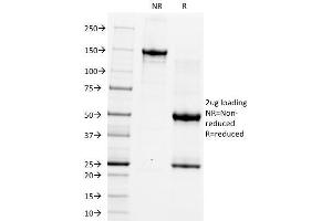 SDS-PAGE Analysis Purified CD5 Monoclonal Antibody (CRIS-1). (CD5 antibody)