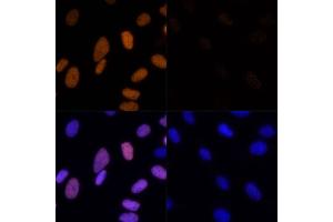 Immunofluorescence analysis of U-2 OS cells using Acetyl-Histone H3-K23 (ABIN7267669) at dilution of 1:100. (Histone 3 antibody  (H3K23))
