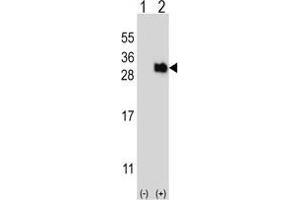 Western blot analysis of UBTD1 (arrow) using rabbit polyclonal UBTD1 Antibody . (UBTD1 antibody)