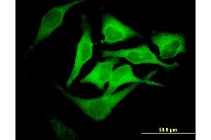 Immunofluorescence of monoclonal antibody to EPB42 on HeLa cell. (EPB42 antibody  (AA 623-721))