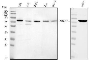 Western blot analysis of Caldesmon using anti-Caldesmon antibody (ABIN4886498). (Caldesmon antibody  (AA 1-120))