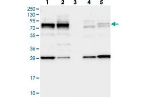 Western blot analysis of Lane 1: RT-4, Lane 2: U-251 MG, Lane 3: Human Plasma, Lane 4: Liver, Lane 5: Tonsil with LSG1 polyclonal antibody  at 1:250-1:500 dilution. (Lsg1 antibody)
