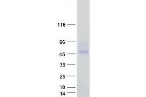 Validation with Western Blot