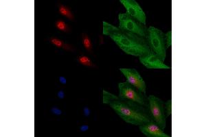 ABIN7094659 and ABIN7098710 staining  cells by IF/ICC.