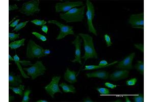 Immunofluorescence of monoclonal antibody to GBF1 on HeLa cell. (GBF1 antibody  (AA 101-209))