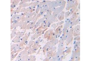 Figure. (VEGFB antibody  (AA 21-137))