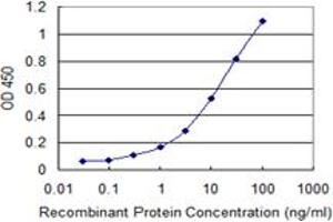 Detection limit for recombinant GST tagged IKBKE is 0. (IKKi/IKKe antibody  (AA 541-640))