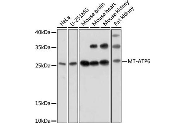MT-ATP6 anticorps