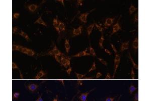 Immunofluorescence analysis of C6 cells using UBE2J1 Polyclonal Antibody at dilution of 1:100. (UBE2J1 antibody)