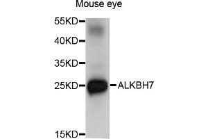 Western blot analysis of extracts of mouse eye, using ALKBH7 antibody (ABIN5971299) at 1/1000 dilution. (ALKBH7 antibody)
