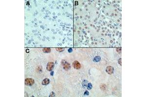 Image no. 1 for anti-Msh Homeobox 1 (MSX1) (AA 50-100) antibody (ABIN207744) (MSX1 antibody  (AA 50-100))