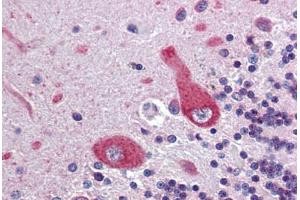 Brain, cerebellum, Human: Formalin-Fixed, Paraffin-Embedded (FFPE) (Ankyrin G antibody  (AA 1690-1701))