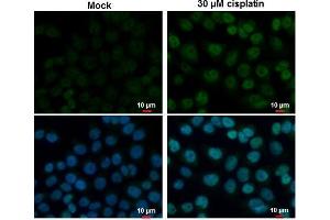 Immunofluorescence (IF) image for anti-Tumor Protein P53 (TP53) antibody (ABIN2855525)