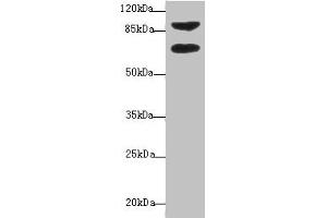 Western blot All lanes: DTX2 antibody at 1 μg/mL + HepG2 whole cell lysate Secondary Goat polyclonal to rabbit IgG at 1/10000 dilution Predicted band size: 68, 63 kDa Observed band size: 68, 92 kDa (DTX2 antibody  (AA 1-280))