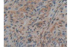 Immunohistochemistry (IHC) image for anti-Tumor Necrosis Factor Receptor Superfamily, Member 11a, NFKB Activator (TNFRSF11A) (AA 31-214) antibody (ABIN7434632)