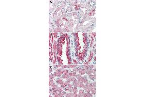 Immunohistochemical staining of formalin-fixed, paraffin-embedded human kidney (A), human prostate (B) and human liver (C) tissue after heat-induced antigen retrieval. (GPR146 antibody  (Internal Region))