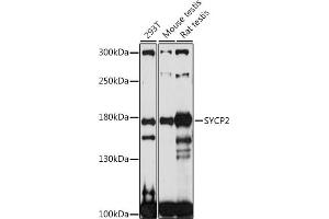 Western blot analysis of extracts of various cell lines, using SYCP2 antibody (ABIN7270668) at 1:1000 dilution. (SYCP2 antibody  (AA 1231-1530))