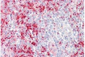 Human Spleen: Formalin-Fixed, Paraffin-Embedded (FFPE) (Septin 1 antibody  (C-Term))