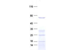 Validation with Western Blot (MUTYH Protein (His tag))