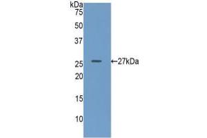 Western blot analysis of recombinant Human GUSb. (Glucuronidase beta antibody  (AA 451-649))