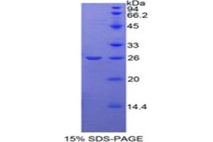 SDS-PAGE analysis of Rat NAGase Protein. (MGEA5 Protein)