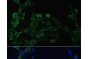 Immunofluorescence analysis of NIH/3T3 cells using EEF1B2 Polyclonal Antibody at dilution of 1:100. (EEF1B2 antibody)