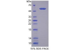 SDS-PAGE (SDS) image for Tyrosyl-DNA Phosphodiesterase 1 (TDP1) (AA 4-215) protein (His tag,GST tag) (ABIN6239377) (TDP1 Protein (AA 4-215) (His tag,GST tag))