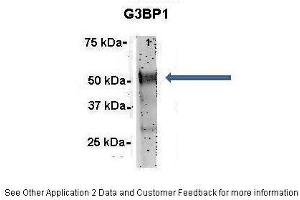 Immunoprecipitation (IP) image for anti-GTPase Activating Protein (SH3 Domain) Binding Protein 1 (G3BP1) (N-Term) antibody (ABIN2780222)
