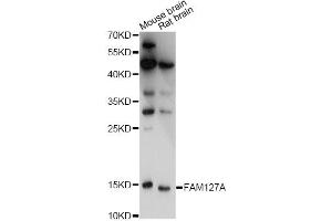 Western blot analysis of extracts of various cell lines, using FAM127A antibody. (CXX1 antibody)