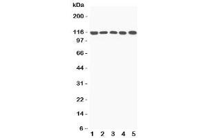 Western Blotting (WB) image for anti-Complement Component 5a (C5a) (N-Term) antibody (ABIN3029692)