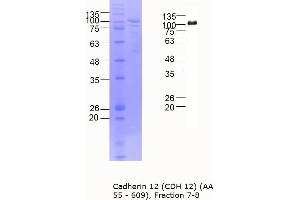 Western Blotting (WB) image for Cadherin 12 (AA 55-609) protein (MBP tag) (ABIN3090213) (Cadherin 12 Protein (AA 55-609) (MBP tag))