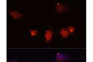 Immunofluorescence analysis of U-251MG cells using NPY Polyclonal Antibody at dilution of 1:100 (40x lens). (NPY antibody)
