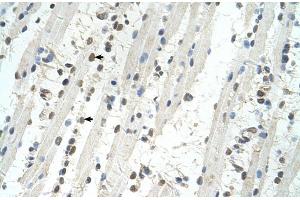Human Muscle (TRIM32 antibody  (C-Term))