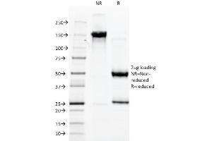 SDS-PAGE Analysis Purified AFP Mouse Monoclonal Antibody (C2). (alpha Fetoprotein antibody)